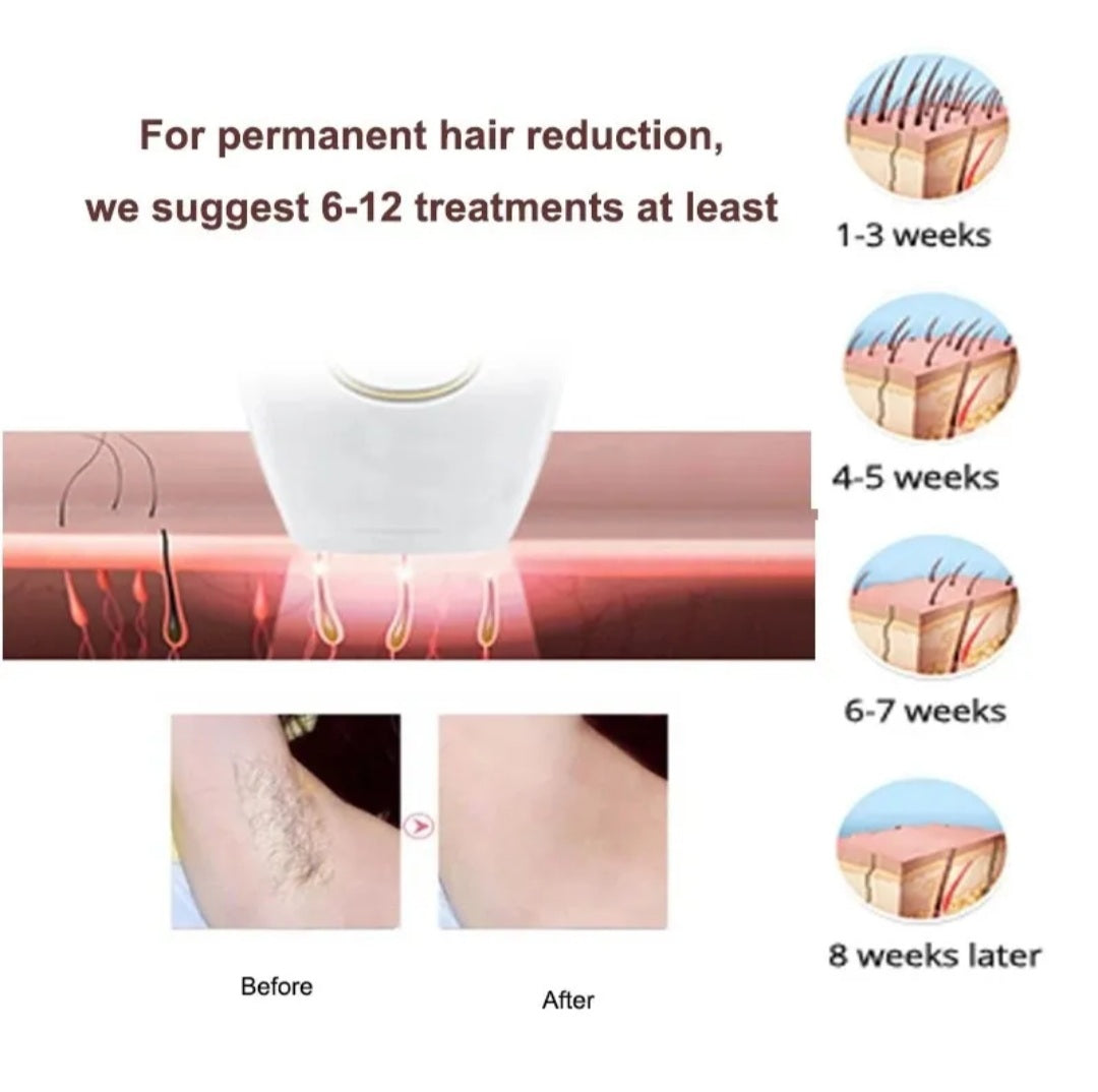 Professional IPL Hair Removal Handset for Women & Men – Includes Razor & Safety Glasses