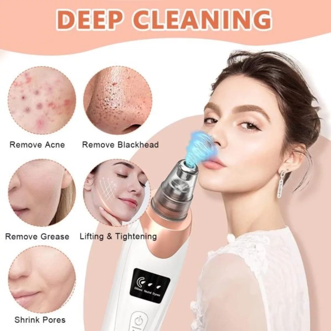 5-in-1 Facial Blackhead Remover | Rechargeable Pore Vacuum with 5 Interchangeable Heads