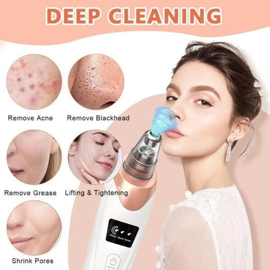 5-in-1 Facial Blackhead Remover | Rechargeable Pore Vacuum with 5 Interchangeable Heads